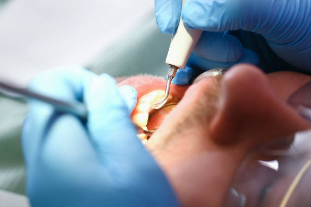 Best Broken or Chipped Tooth Repair in Princeton, WV