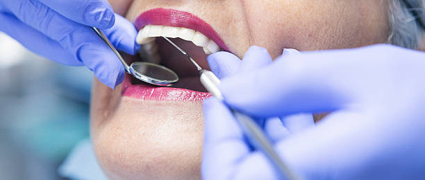 Best Emergency Treatment for Oral Infections in Princeton, WV